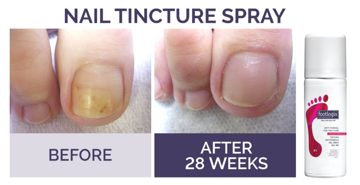 Footlogix Toe Nail Tincture, 50 ml product infographic