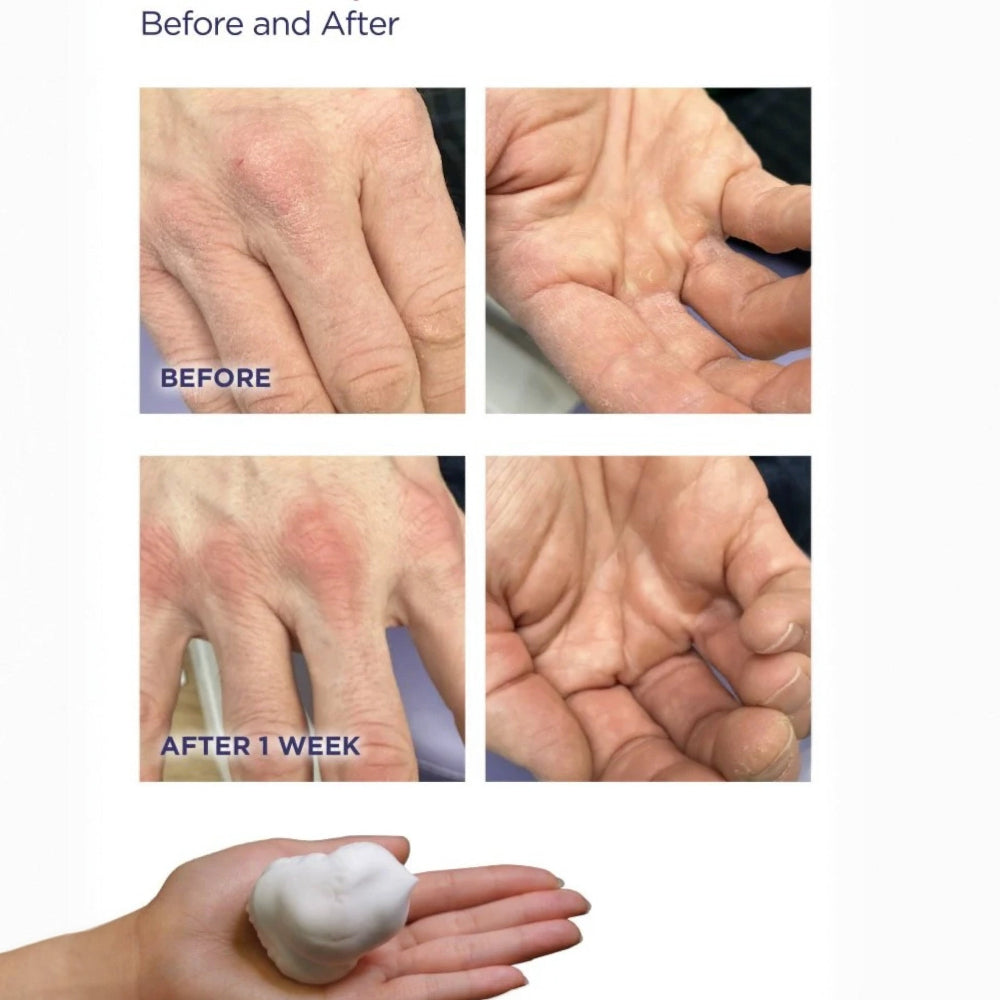 Footlogix Hydrating Hand Mousse, 125 ml product exsample