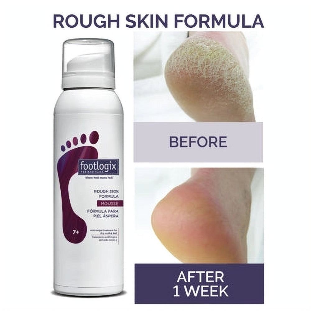 Footlogix Rough Skin Formula, 125 ml product infographic
