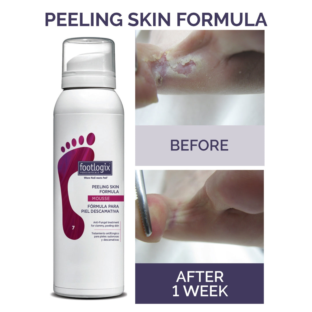 Footlogix Peeling Skin Formula, 125 ml product infographic