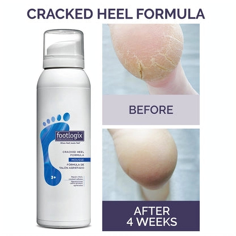 Footlogix Cracked Heel Formula, 125 ml product packaging