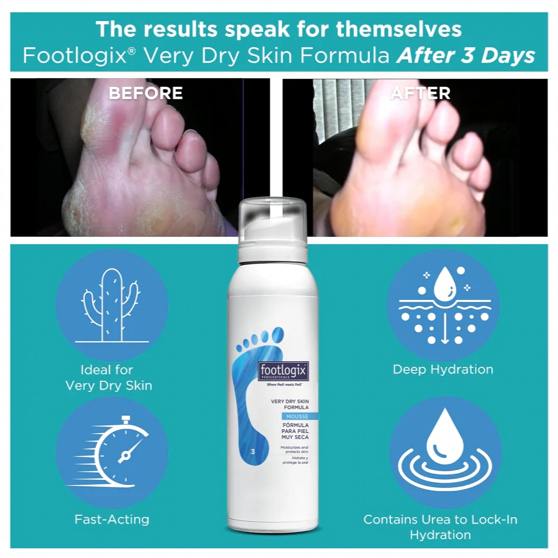 Footlogix Very Dry Skin Formula, 125 ml product packaging